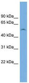 Family With Sequence Similarity 83 Member F antibody, TA340290, Origene, Western Blot image 