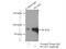 Procollagen-Lysine,2-Oxoglutarate 5-Dioxygenase 3 antibody, 60058-1-Ig, Proteintech Group, Immunoprecipitation image 