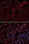 Proteasome 26S Subunit, ATPase 2 antibody, A09306, Boster Biological Technology, Western Blot image 