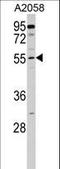 Carnosine Dipeptidase 2 antibody, LS-C168873, Lifespan Biosciences, Western Blot image 