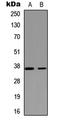 Nei Like DNA Glycosylase 2 antibody, LS-C354436, Lifespan Biosciences, Western Blot image 