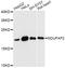 NADH:Ubiquinone Oxidoreductase Complex Assembly Factor 2 antibody, A14296, ABclonal Technology, Western Blot image 