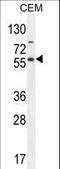 NFKB Inhibitor Like 1 antibody, LS-C164855, Lifespan Biosciences, Western Blot image 