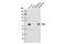 Checkpoint Kinase 2 antibody, 6334T, Cell Signaling Technology, Western Blot image 