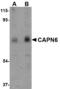 Calpain 6 antibody, A09778, Boster Biological Technology, Western Blot image 