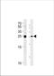 MOB Kinase Activator 1B antibody, TA324899, Origene, Western Blot image 