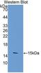Toll Like Receptor 3 antibody, LS-C301235, Lifespan Biosciences, Western Blot image 