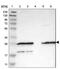 Farnesyltransferase, CAAX Box, Alpha antibody, NBP1-83428, Novus Biologicals, Western Blot image 