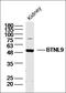 Complement Factor Properdin antibody, orb2097, Biorbyt, Western Blot image 