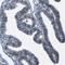 Stromal interaction molecule 1 antibody, NBP1-84322, Novus Biologicals, Immunohistochemistry paraffin image 