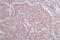 Choline O-Acetyltransferase antibody, CSB-PA005314LA01HU, Cusabio, Immunohistochemistry paraffin image 