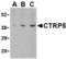 C1q And TNF Related 5 antibody, TA306237, Origene, Western Blot image 