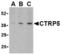 C1q And TNF Related 5 antibody, TA306237, Origene, Western Blot image 