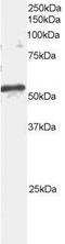 ADP Ribosylation Factor GTPase Activating Protein 3 antibody, NB100-843, Novus Biologicals, Western Blot image 