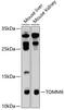 Translocase Of Outer Mitochondrial Membrane 6 antibody, 19-549, ProSci, Western Blot image 