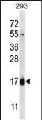 Hemoglobin Subunit Theta 1 antibody, PA5-48492, Invitrogen Antibodies, Western Blot image 