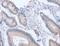Activin A Receptor Type 1C antibody, LS-C404431, Lifespan Biosciences, Immunohistochemistry paraffin image 