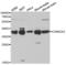 Casein Kinase 2 Alpha 1 antibody, LS-C331589, Lifespan Biosciences, Western Blot image 