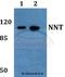 Nicotinamide Nucleotide Transhydrogenase antibody, A00887, Boster Biological Technology, Western Blot image 