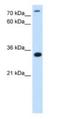 TAM41 Mitochondrial Translocator Assembly And Maintenance Homolog antibody, NBP1-79269, Novus Biologicals, Western Blot image 