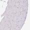 Neurofibromin 1 antibody, NBP2-37914, Novus Biologicals, Immunohistochemistry paraffin image 