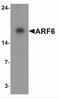 ADP Ribosylation Factor 6 antibody, NBP2-41263, Novus Biologicals, Western Blot image 