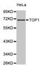 DNA Topoisomerase I antibody, abx002628, Abbexa, Western Blot image 