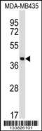 Surfactant Protein D antibody, 57-407, ProSci, Western Blot image 