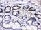 Cyclin Dependent Kinase 4 antibody, PB9535, Boster Biological Technology, Immunohistochemistry paraffin image 