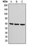 ATP Synthase F1 Subunit Alpha antibody, LS-C351856, Lifespan Biosciences, Western Blot image 