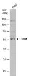ETS Variant 1 antibody, PA5-77975, Invitrogen Antibodies, Western Blot image 