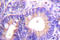 Cbl Proto-Oncogene antibody, LS-C176316, Lifespan Biosciences, Immunohistochemistry paraffin image 