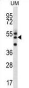 Regulator Of Microtubule Dynamics 2 antibody, abx029775, Abbexa, Western Blot image 
