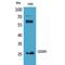 Protein C Receptor antibody, LS-C387052, Lifespan Biosciences, Western Blot image 