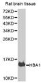 Hemoglobin Subunit Alpha 2 antibody, MBS126252, MyBioSource, Western Blot image 