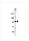 Enhancer Of Zeste 2 Polycomb Repressive Complex 2 Subunit antibody, MBS9211332, MyBioSource, Western Blot image 