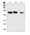 OFD1 Centriole And Centriolar Satellite Protein antibody, A02955-1, Boster Biological Technology, Western Blot image 