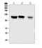 OFD1 antibody, A02955-1, Boster Biological Technology, Western Blot image 