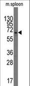 Poly(ADP-Ribose) Polymerase Family Member 3 antibody, LS-C100025, Lifespan Biosciences, Western Blot image 