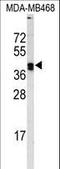 Protein-lysine 6-oxidase antibody, LS-C165844, Lifespan Biosciences, Western Blot image 