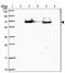 Transmembrane Phosphatase With Tensin Homology antibody, NBP2-33576, Novus Biologicals, Western Blot image 