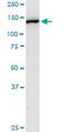 Ribosomal Protein L4 antibody, H00006124-D01P, Novus Biologicals, Western Blot image 