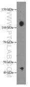 Cbl Proto-Oncogene B antibody, 66353-1-Ig, Proteintech Group, Western Blot image 