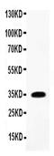 Interleukin 1 Beta antibody, PA5-79485, Invitrogen Antibodies, Western Blot image 