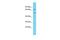 Deltex E3 Ubiquitin Ligase 4 antibody, PA5-46146, Invitrogen Antibodies, Western Blot image 