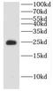 Deoxythymidylate Kinase antibody, FNab02558, FineTest, Western Blot image 