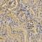 Proteasome 26S Subunit, Non-ATPase 9 antibody, PA5-76792, Invitrogen Antibodies, Immunohistochemistry paraffin image 