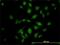 ATPase Secretory Pathway Ca2+ Transporting 1 antibody, H00027032-M01, Novus Biologicals, Immunocytochemistry image 