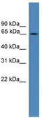 TBC1 Domain Family Member 19 antibody, TA344883, Origene, Western Blot image 