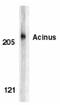 Apoptotic Chromatin Condensation Inducer 1 antibody, LS-C373, Lifespan Biosciences, Western Blot image 